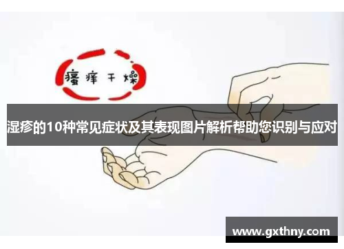湿疹的10种常见症状及其表现图片解析帮助您识别与应对